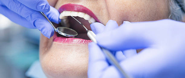 Best Emergency Wisdom Teeth Removal in Port St Joe, FL